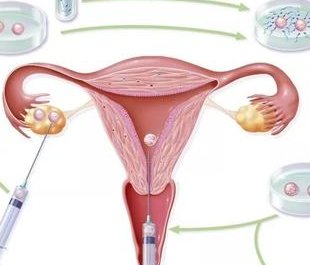 2026呼和浩特试管婴儿花费明细表附试管医院名单整理